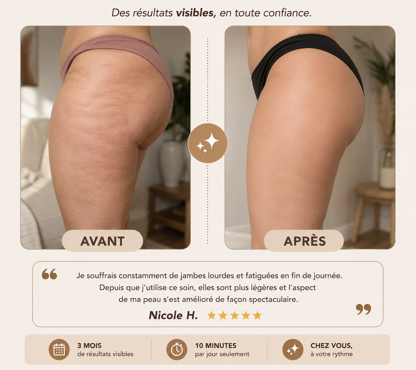 Masseur anti-cellulite LICELIA